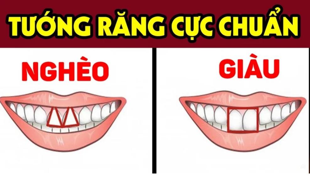 Dù là nam hay nữ, nếu sở hữu 4 chiếc răng này thì bạn thường nghèo khó, khó khăn trong các mối quan hệ và dễ cô đơn khi về già.